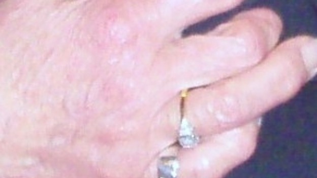 Stolen ring
