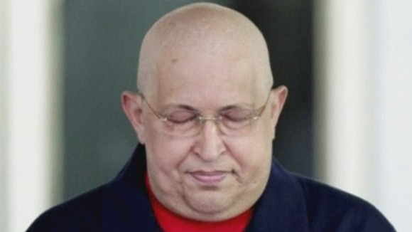 Hugo Chavez bears his bald head after chemotherapy treatment