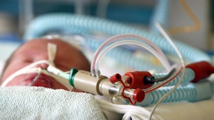 A premature baby