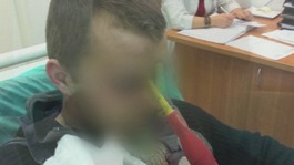 A Polish man, with his identity concealed, is seen with the screwdriver in his head