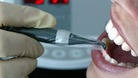 A dentist carries out treatment