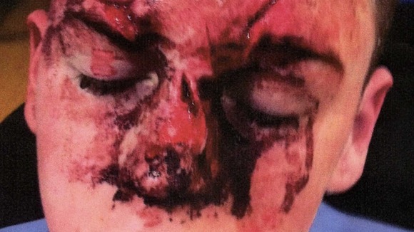 Injured face