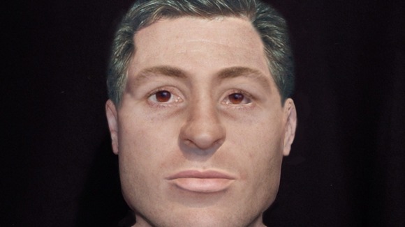 Robert Williams reconstruction