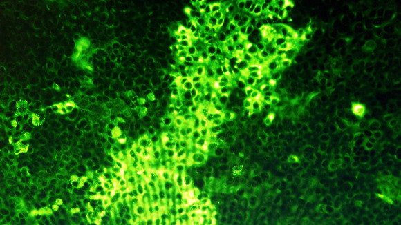 A monitor shows cells infected with the Schmallenberg virus