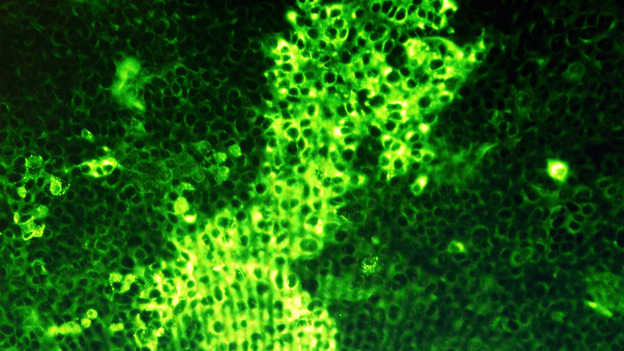 A monitor shows cells infected with the Schmallenberg virus