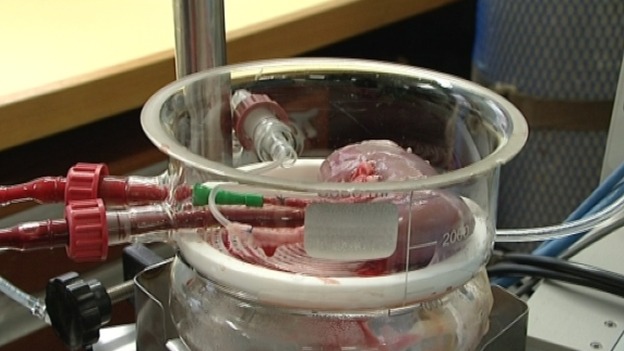 A kidney being used in a transplant