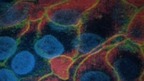 Microscopic image of meningitis bacteria