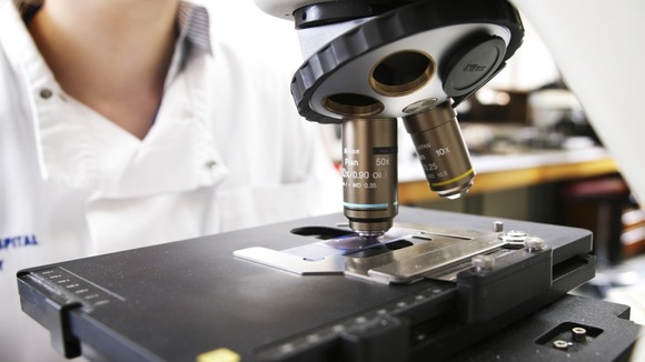 Prostate cancer is the most common cancer among men