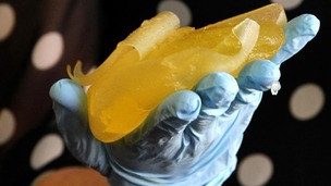 A Scottish PIP implant victim holding one of her ruptured PIP implants after having it removed.