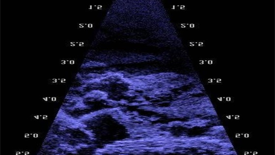 An acoustic image of the lost town