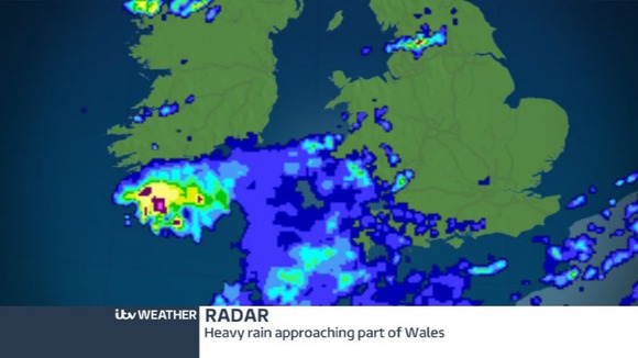 Radar