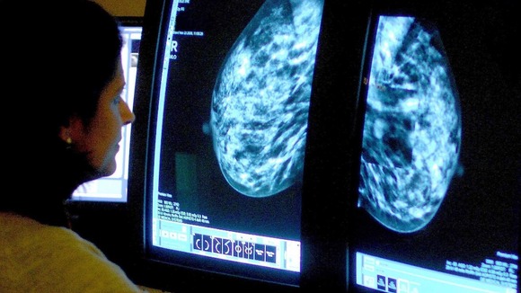 A consultant analyzing a mammogram.