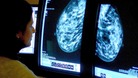 A consultant analyzing a mammogram.