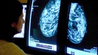 A consultant analyzing a mammogram.