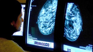  A consultant analyzing a mammogram.