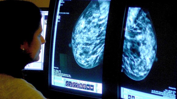 A doctor looking at a mammogram X-ray.