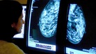 A doctor looking at a mammogram X-ray.