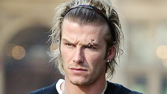 It was rumoured that Beckham's eye injury was accidentally inflicted by his manager