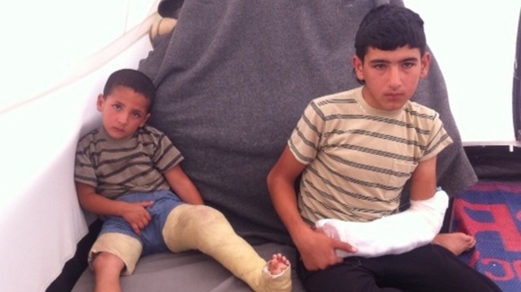Ahmad, 4, and his brother Mohammad, 14, were wounded when a shell hit their kitchen in Deraa