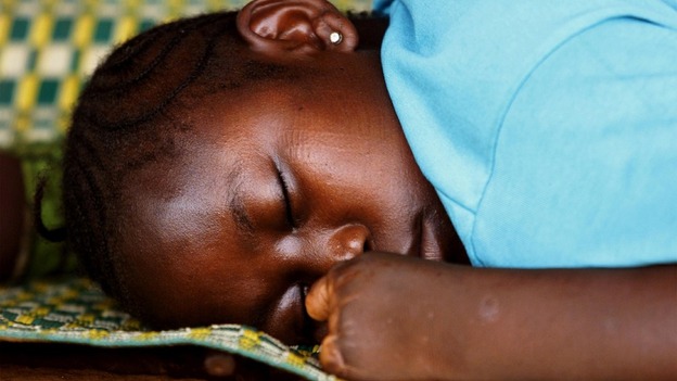 A Sierra Leonean girl who had her hand amputated by RUF rebels in January 1999 sleeps in a refugee camp in Freetown in this May 16, 2000
