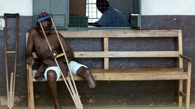 A Sierra Leonean man amputated by the RUF rebels sits on a bench in a refugee camp in Freetown in 1999