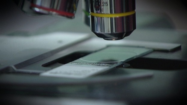 The guidelines say the NHS should offer testing to healthy people if it is likely they have a genetic mutation in their family