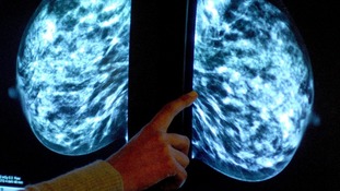 Tamoxifen will be available to women on the NHS
