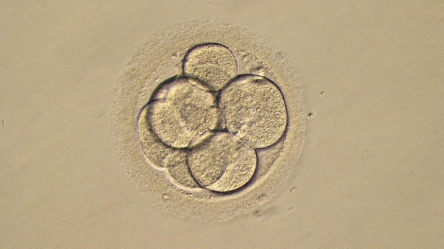 A three-day-old human embryo.