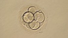 A three-day-old human embryo.