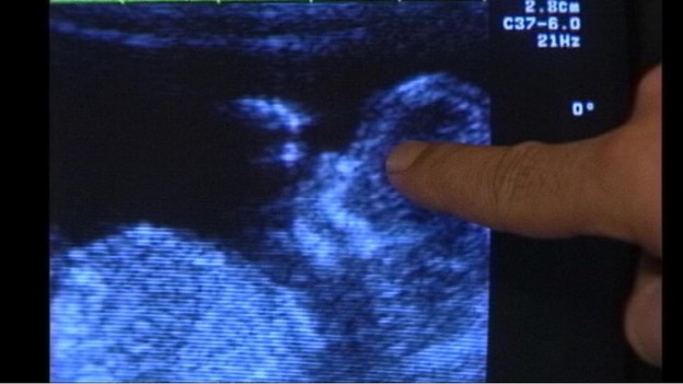 Anti-abortion campaigners will hold vigils in more than 50 UK towns and cities