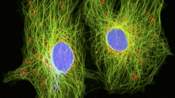 Scientists have discovered a new molecule that prevents cancer cells from surviving when starved of oxygen.