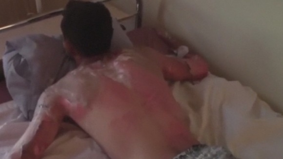 Images from Syria show people being treated for severe burns after what could have been an incendiary attack.