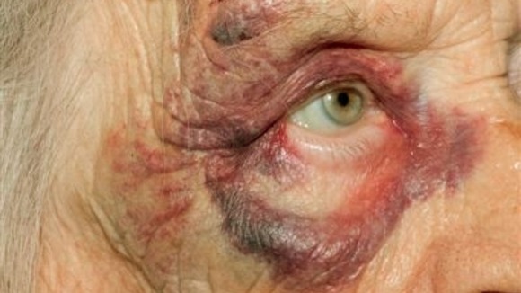 Essex police have released this image of the victim