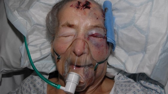  Emma Winnall in hospital 
