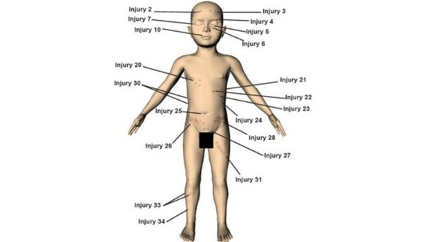 A police image illustrating some of the 37 injuries identified on the body of Keanu Williams.