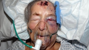 Emma Winnall, who is 94, was attacked in her bed in Birmingham.