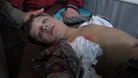 Another civilian victim of the brutal conflict in Syria, being treated by surgeons.
