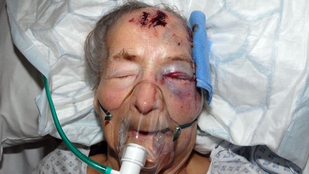 Emma Winnall was assaulted in her bed at her Moseley home.