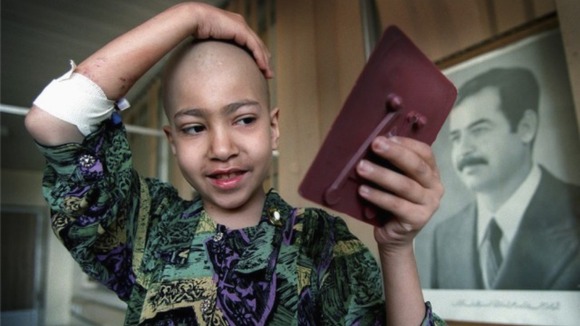 Marwa Najem, 11, examines her missing hair whilst undergoing treatment for leukemia in Baghdad's Children's Hospital.