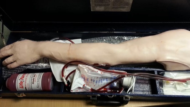Arm