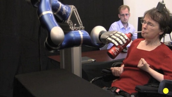 Cathy Hutchinson controls the robot arm by imagining the movement