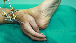 Xiao Wei's right hand attached to his ankle.