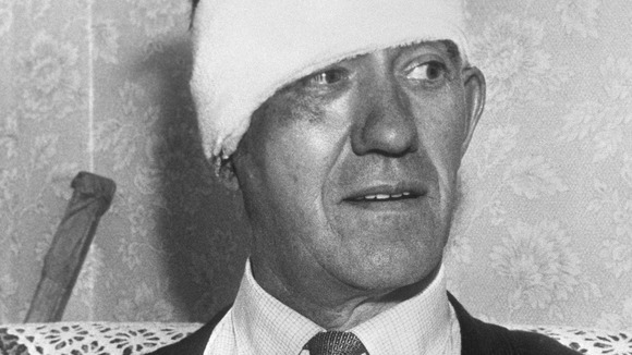 Train driver Jack Mills with his head bandaged.