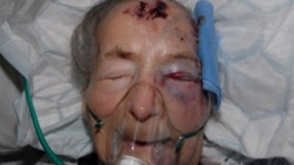 Emma Winnall in hospital 