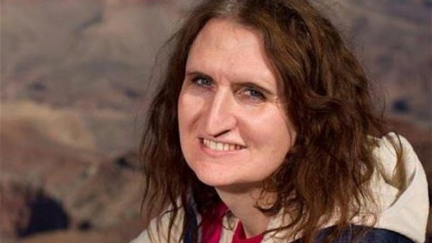 Kate Stone was attacked by a stag in Scotland.