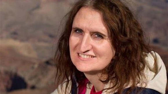 Kate Stone was attacked by a stag in Scotland.