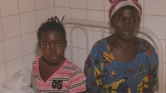 During a three-week trek to escape the violence this 11-year-old girl lost her sister and could now lose her leg.