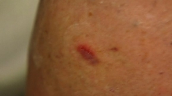 Bob McKeown was left with a small scratch on his calf
