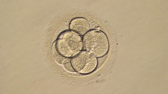 A photo of a three-day-old human embryo before the IVF vitrification process