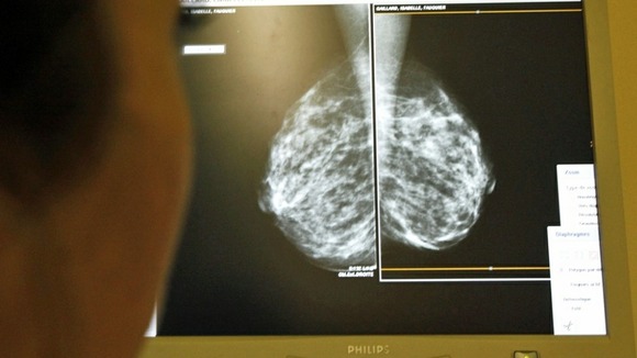 HRT therapy could have increased breast cancer chances, while above a doctor performs checks to find the disease